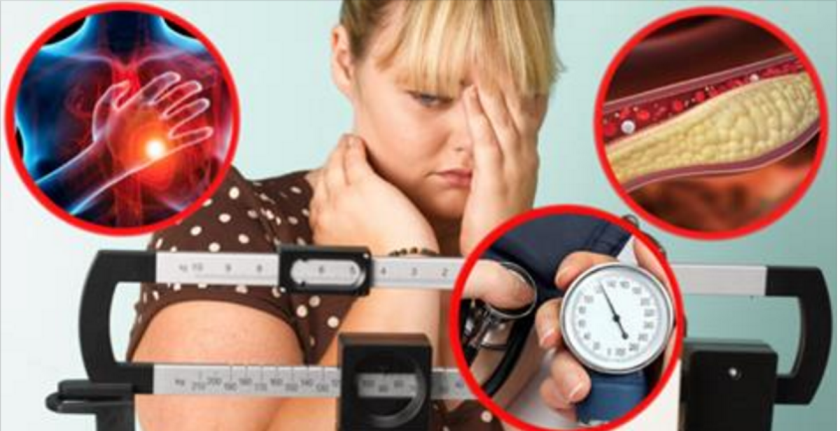 Лишний Вес Проблемы Со Здоровьем